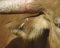 Abscess
